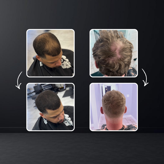 Krowned™ - Instant Hair Density