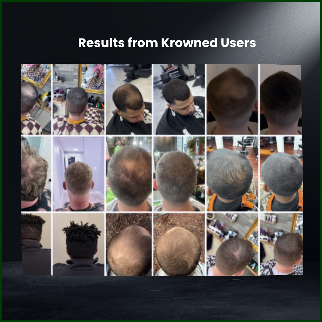 Krowned™ Water, Sweat, and Wind Proof — For Real Life Hair Density
